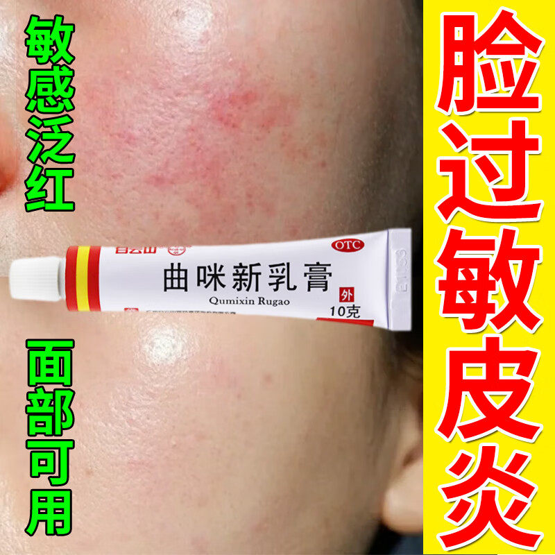 脸部过敏专用药 皮肤瘙痒接触性皮炎湿疹脸过敏药膏皮肤干痒红肿C