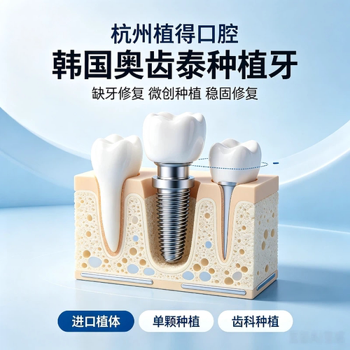 杭州植得口腔韩国奥齿泰种植牙微创即刻种植牙齿缺失修复口腔种植