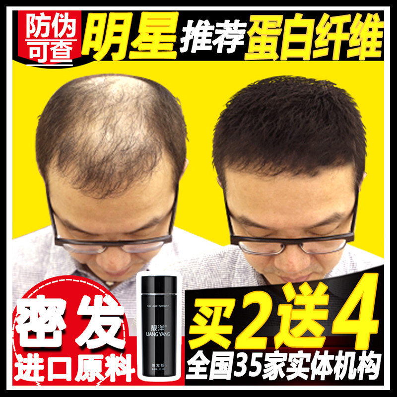 靓洋头发纤维粉增发纤维发际线喷雾稀疏遮盖补发密发缝秃顶神器
