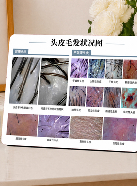 头皮毛发科普店用摆件专业拓客
