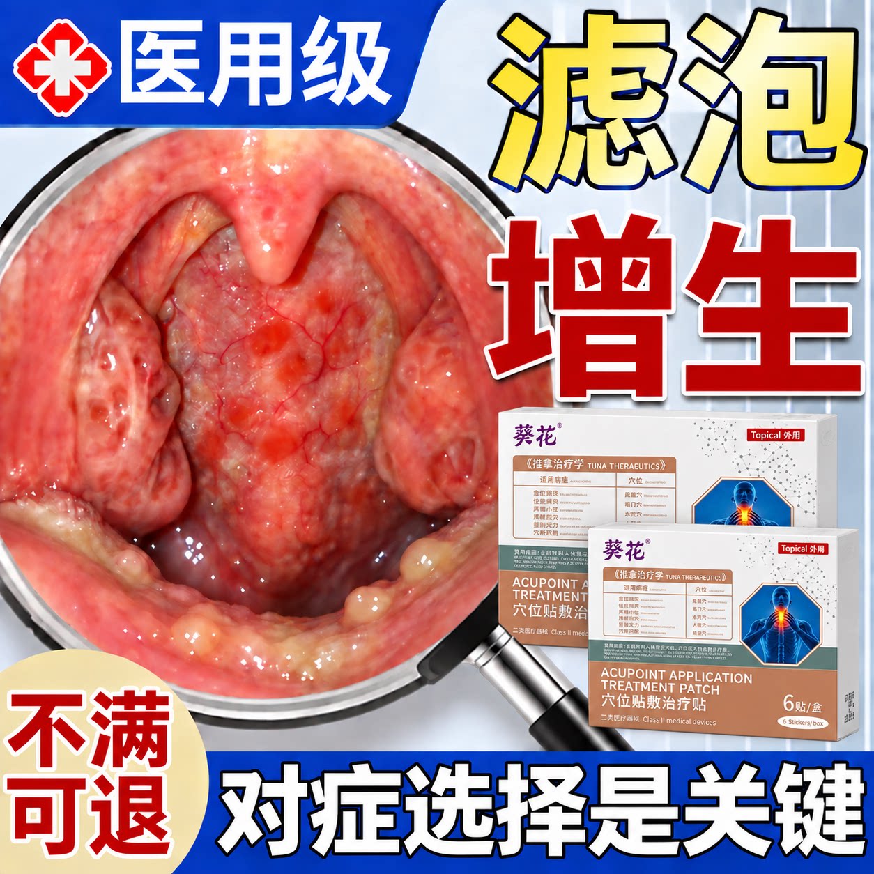 喉咙滤泡增生慢性咽炎