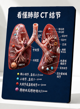 肺部CT结节科普店用吸睛摆件