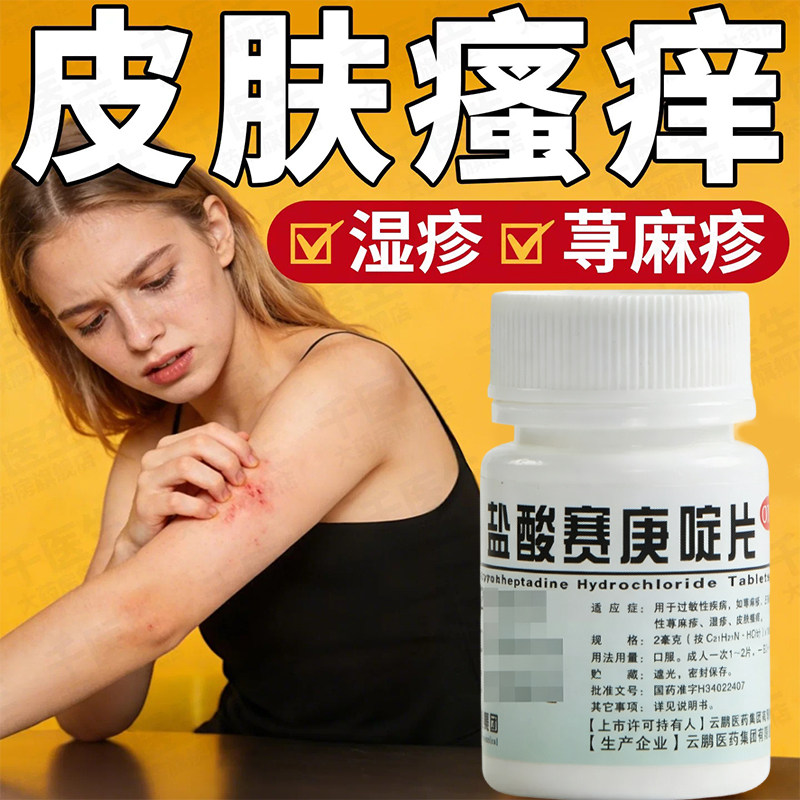 盐酸赛庚啶片100片正品湿疹荨麻疹过敏止痒断皮肤瘙痒根专用药