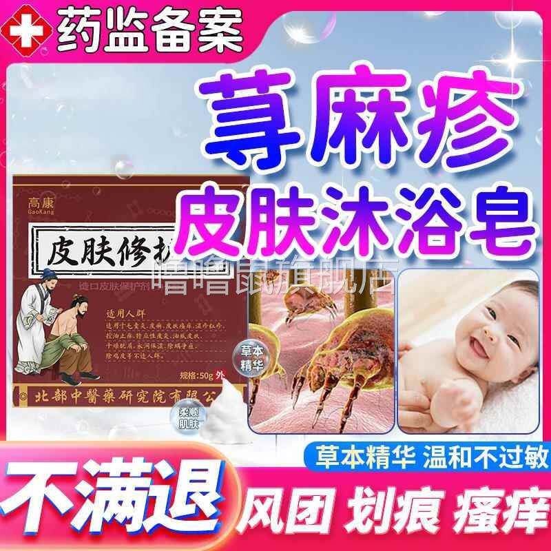 噜噜鼠正品慢性寻荨麻疹过敏止沐浴露皂止膏根提高免疫力根专用CS