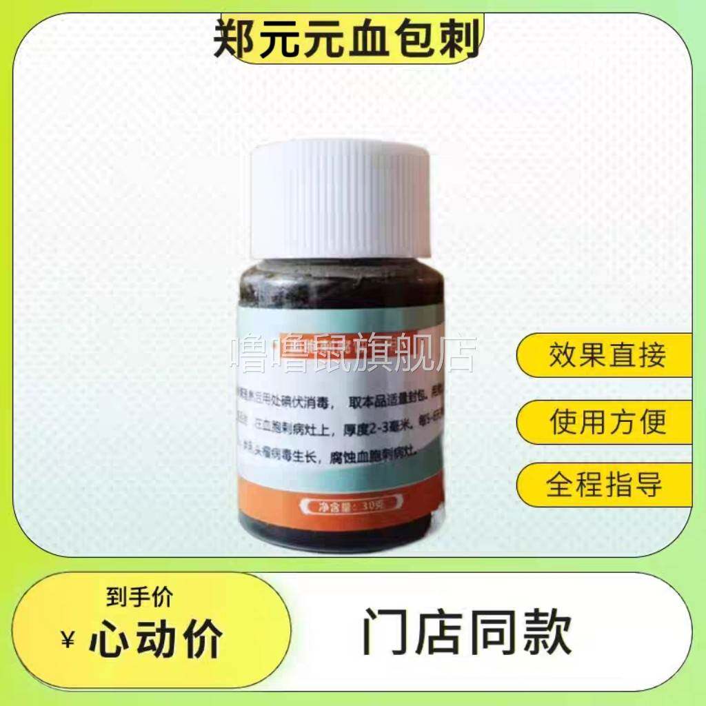 噜噜鼠正品[官方]郑黑药血胞刺去除膏肉刺脱甲膏全程指导使用天猫