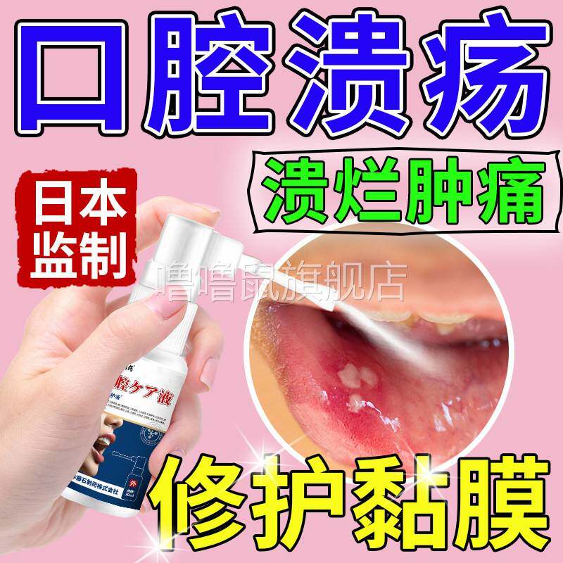 噜噜鼠正品日本口腔溃疡修复液喷雾喷剂凝胶灵药膏溃疡嘴巴舌头口