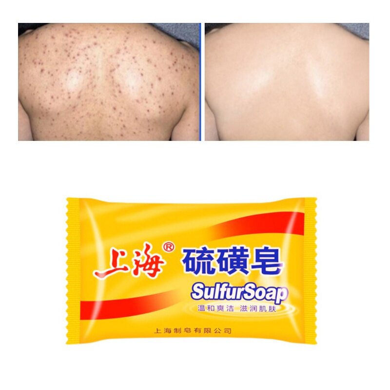 85g Shanghai Sulfur Soap Oil-Control Acne 身体磨砂膏soap