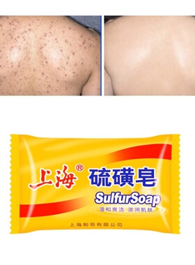 85g Shanghai Sulfur Soap Oil-Control Acne 身体磨砂膏soap