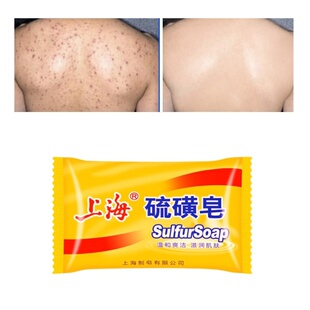 Soap Sulfur Shanghai 身体磨砂膏soap Control Acne Oil 85g