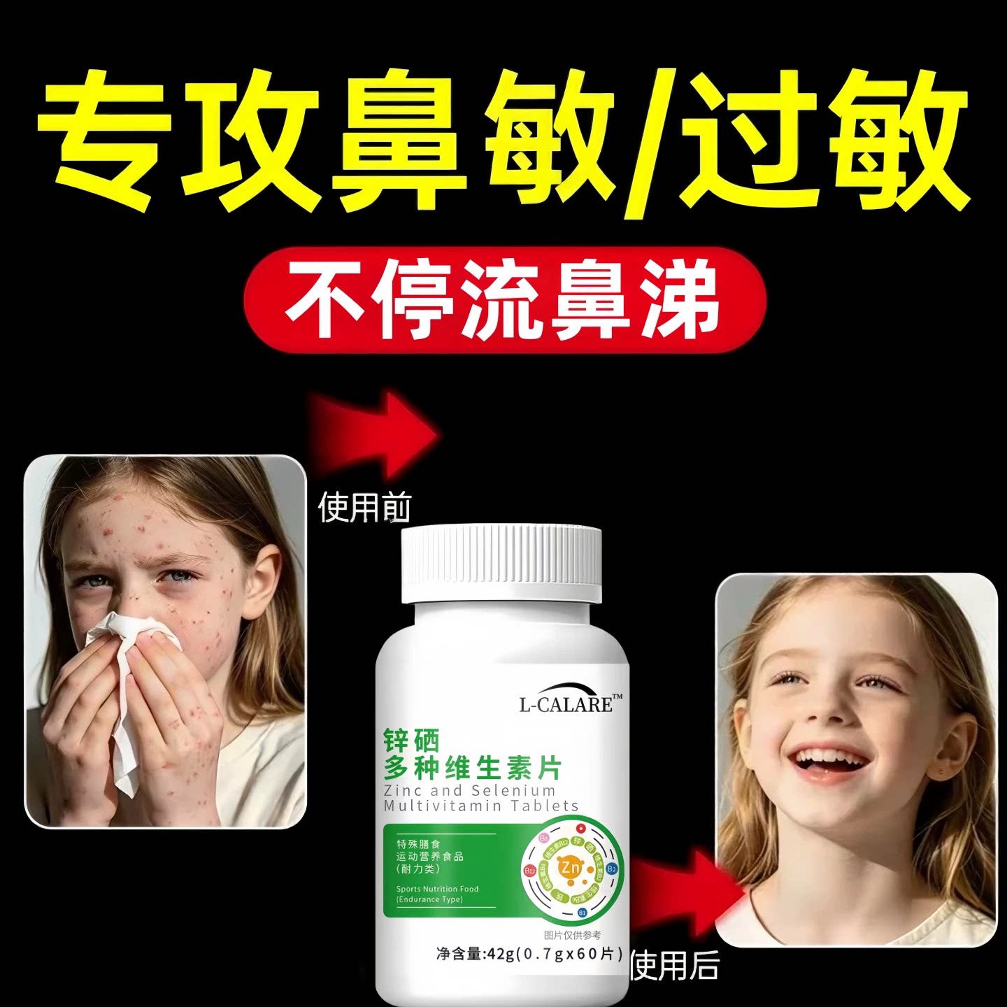 贝速臣多维素片过敏鼻塞痒调理