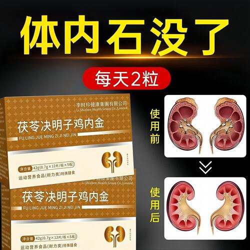 万合石通宝温和调理护胆肾