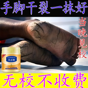 手指头裂口子开裂脱皮裂开干裂愈合膏护手霜手足开口手脚皲裂修复