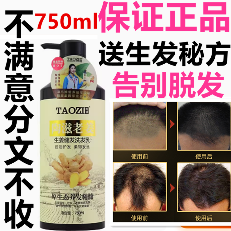 正品陶滋台湾老生姜洗发水乳控油无硅油健发去屑止痒防掉脱育发液