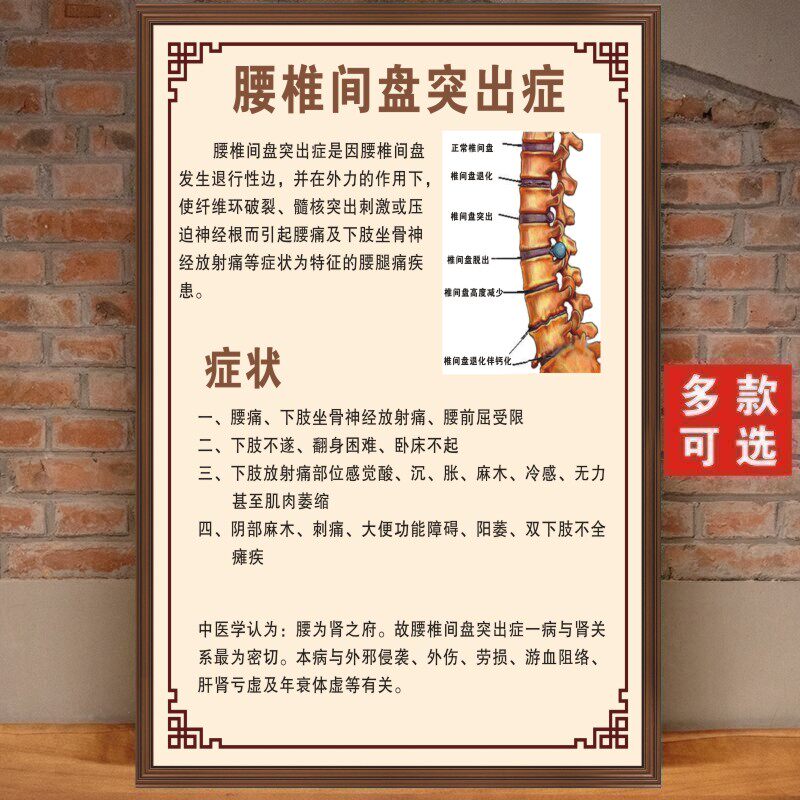 腰椎间盘突出症海报症状挂图中医养生馆装饰画正骨推拿店墙贴定制