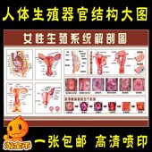女性生殖系统结构解剖图海报张贴画 宫颈疾病糜烂示意图墙贴挂画