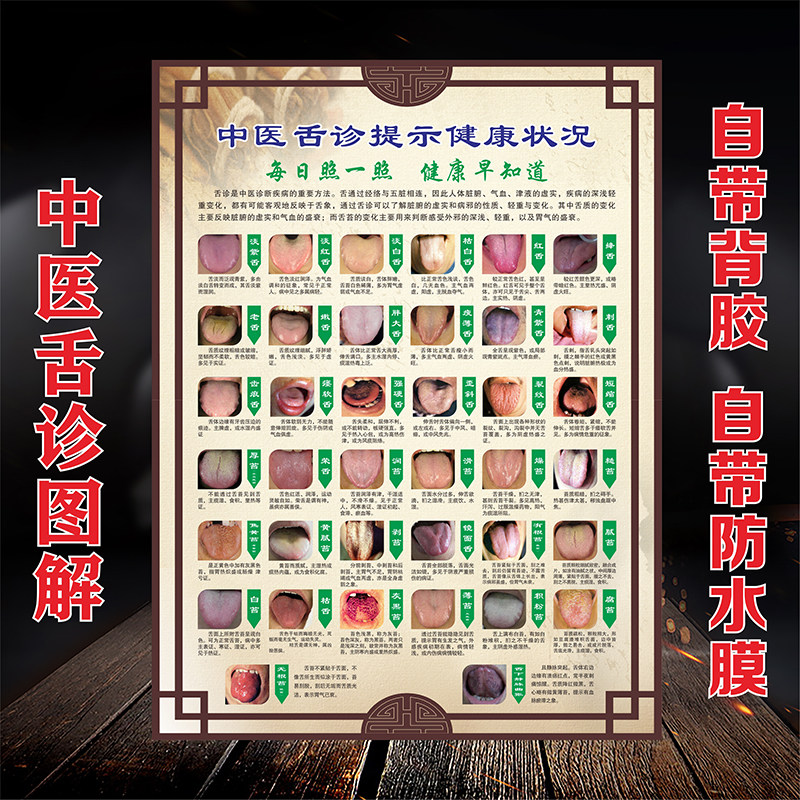 舌诊辩证图解海报中医舌诊健康对照表图中医养生挂图空腔健康贴画