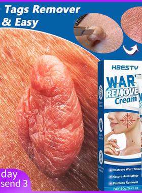 Skin Tag Remover Cream Painless Mole Skin Dark Spot Warts Re