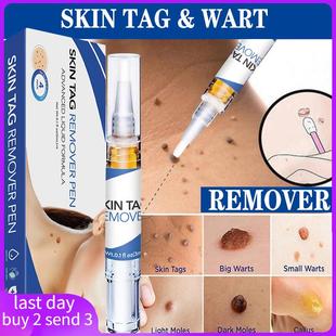 Hours Remover Genital Removal Fast Moles Agat Tag Skin