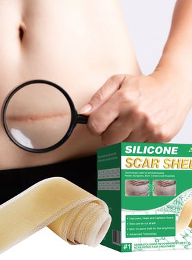 Potongan Gel Silikon ALIVER Koyo Lembaran Bekas Luka Silikon