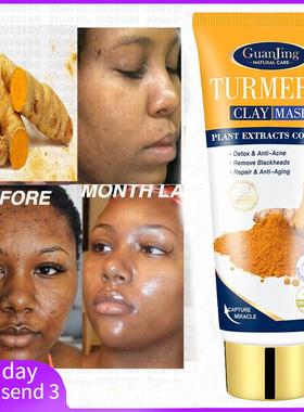 Anti Acne Tumeric Mud Mask Facial Clean Blackhead姜黄面膜泥