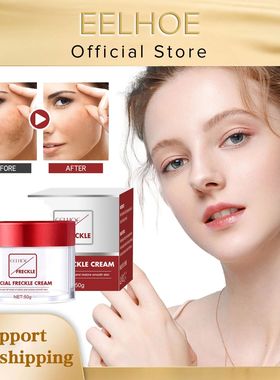 Whitening Spot Cream Lightening Freckle Fade Pigmentation Re