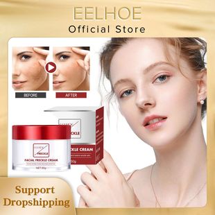 Whitening Spot Cream Lightening Freckle Fade Pigmentation Re