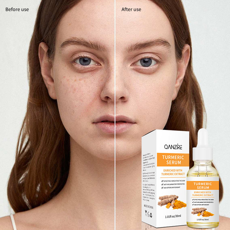 新款推荐全英文姜黄精华液提亮肤色turmeric serum