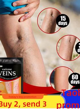 Venous health patch relieves varicose feet 静脉保健贴