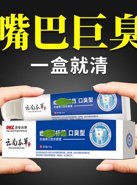 长期口臭【嘴巴巨臭】牙膏口苦干异味肝火旺盛牙膏去黄去渍美白