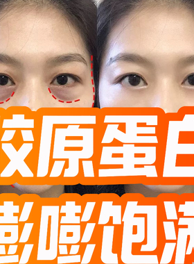 三型胶原蛋白太阳穴面脸部充凹填陷丰眼窝泪沟法令文神器盈精华