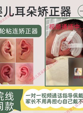 医院同款耳廓矫正器婴儿硅胶耳夹