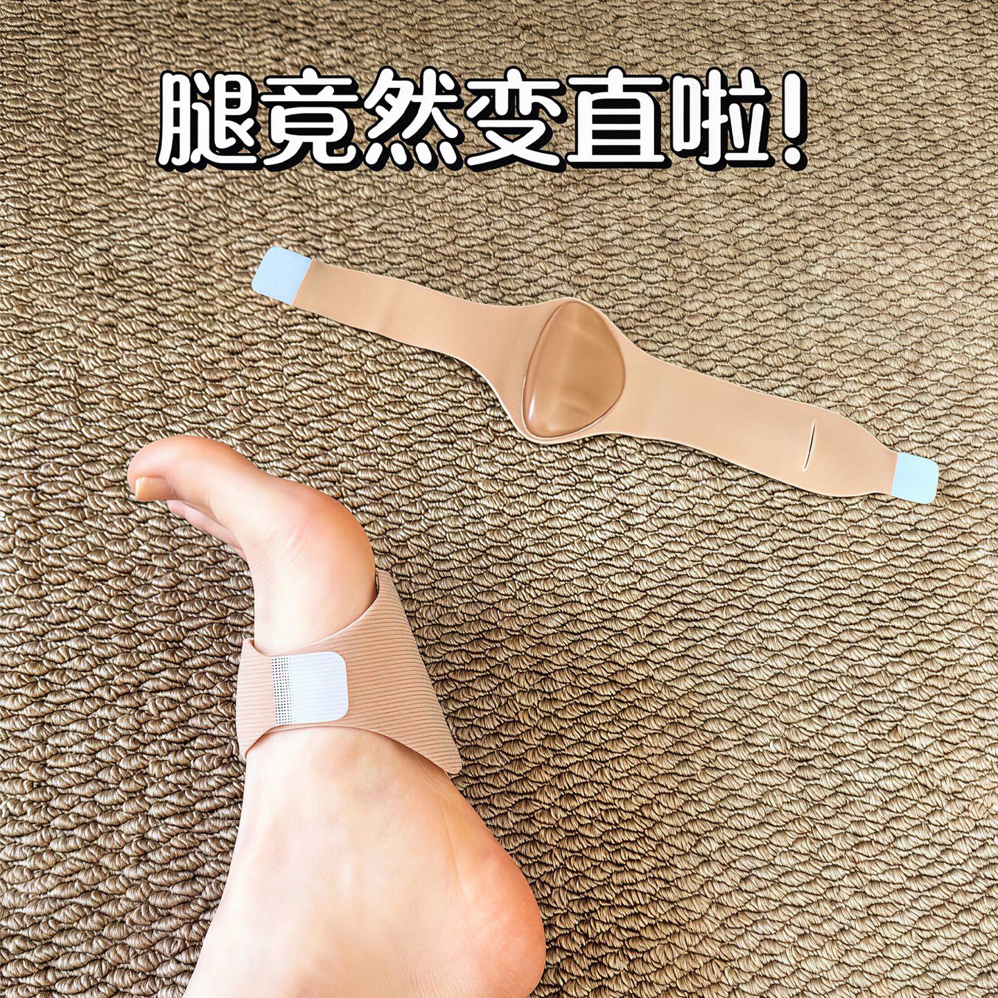 腿竟然变直啦!足弓垫运动气垫直腿神器硅胶托绑带扁平足健身塑型