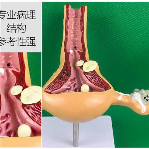 女性生殖模器模型价格 女性生殖模器模型图片 星期三