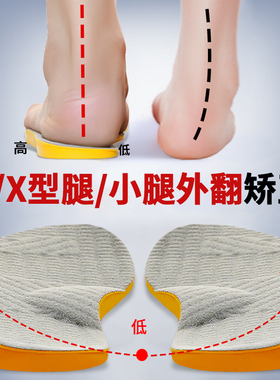 成人xo型腿儿童足外内翻