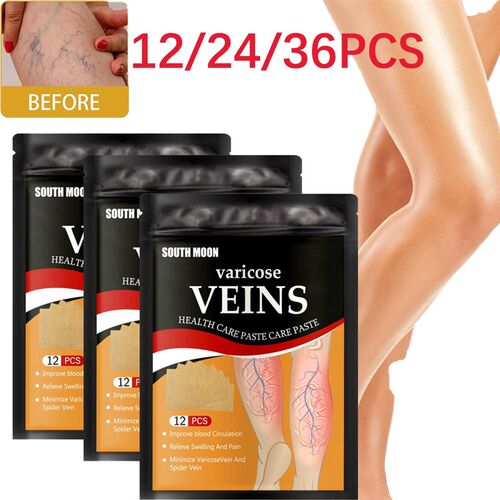 速发12/24/6 Vose Vs Oitmet Vasculitis Phlebitis
