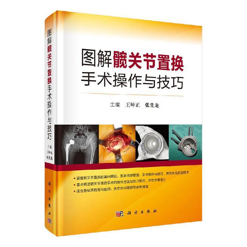 图解髋关节置换手术操作与技巧王坤正 医药卫生书籍