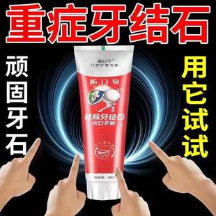 去牙结石牙膏美白口臭祛黄去牙结石牙垢神器去烟渍牙膏家庭装实惠