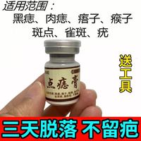古方植物磨痣無痕藥水臉部膏點(diǎn)痣膏專用神器快速點(diǎn)痣膏無痕
