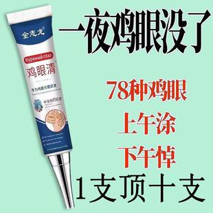金志龙鸡眼清鸡眼膏脚底祛脚垫老茧去除脚茧厚茧鸡眼祛肉刺猴子
