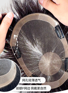 男士头顶假发全手织真发制作秃顶稀疏地中海补发片清爽透气网男款