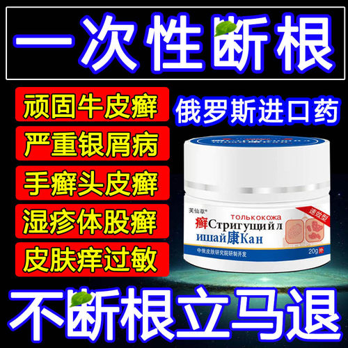 治疗牛皮藓癣银屑病专用老偏方无激素头癣湿疹止痒去特根效药膏