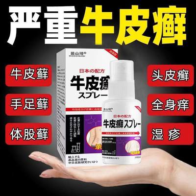 【300%冶好】牛皮癣专用湿疹皮肤瘙痒银屑病止痒去癣特效进口配方