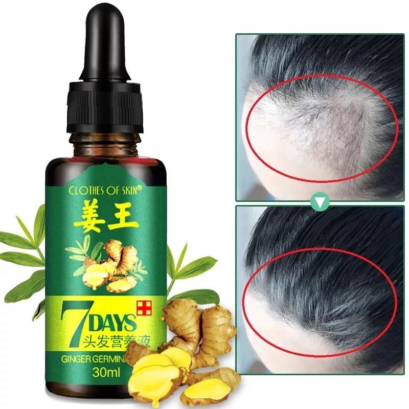 Hair Loss Treatment Ginger Growth Essence Oil老姜头发养护油