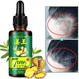 Hair Loss Treatment Ginger Growth Essence Oil老姜头发养护油