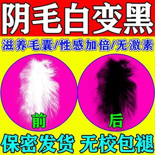 阴毛白变黑白染黑男私处生长液增长私处毛发增毛膏快速浓密染黑剂