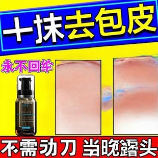 包皮不用割自动脱落修覆收缩矫正器包茎过长隐形阻覆环外翻器