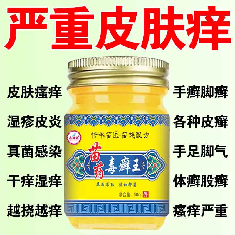 苗药毒藓王皮肤瘙痒干燥瘙痒手脚痒外用全身干痒真菌王快速止痒膏