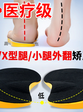儿童成人xo型腿小腿外翻矫正鞋垫