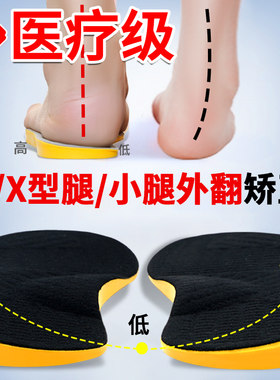 儿童成人xo型腿小腿外翻矫正鞋垫