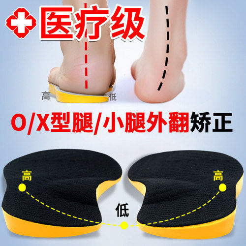 儿童成人xo型腿小腿外翻矫正鞋垫